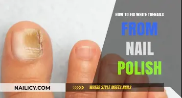 Restore Healthy Toenails: Fixing White Discoloration from Nail Polish