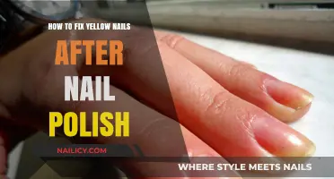 Restore Healthy Nails: Effective Tips to Fix Yellow Nails Post-Polish