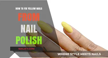 Restore Nail Health: Effective Ways to Fix Yellow Nails from Polish