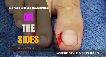 Repairing Nails: Stop Sideways Growth