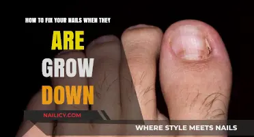 Repairing Nails: Easy Steps to Fix Nails that Grow Downward