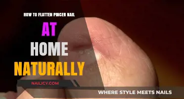 Natural Home Remedies to Flatten Pincer Nails Easily and Effectively