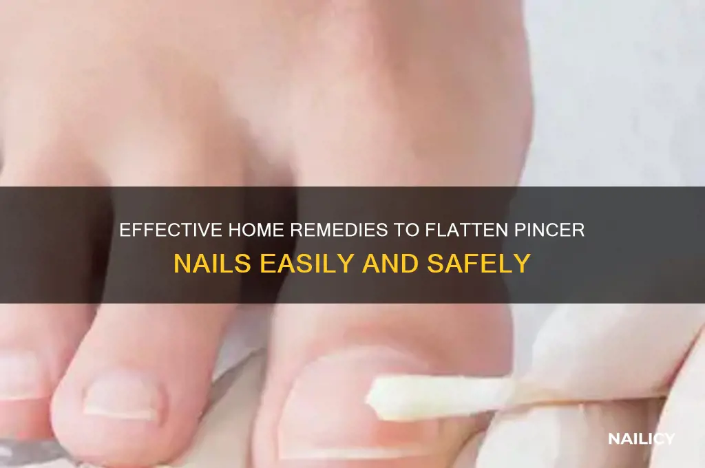 how to flatten pincer nail at home