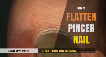 Effective Techniques to Flatten Pincer Nails: A Step-by-Step Guide