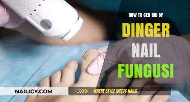 Effective Ways to Eliminate Stubborn Toenail Fungus for Good