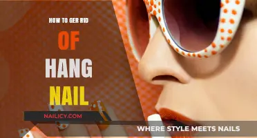 Effective Tips to Heal and Prevent Hangnails Fast and Easily