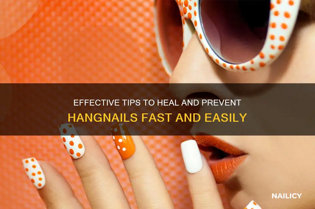 how to ger rid of hang nail