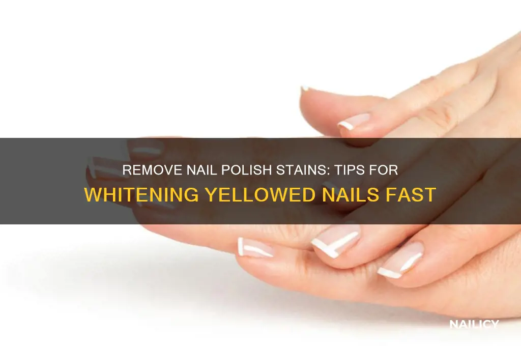 how to getvthe white off of nails from nail polish