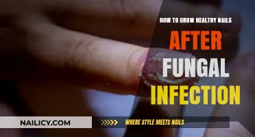 Eradicate Nail Fungus: Healthy Nail Growth Strategies