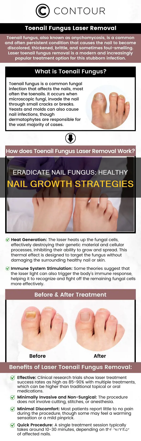 how to grow healthy nails after fungal infection