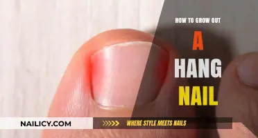 The Ultimate Guide to Growing Out a Hangnail
