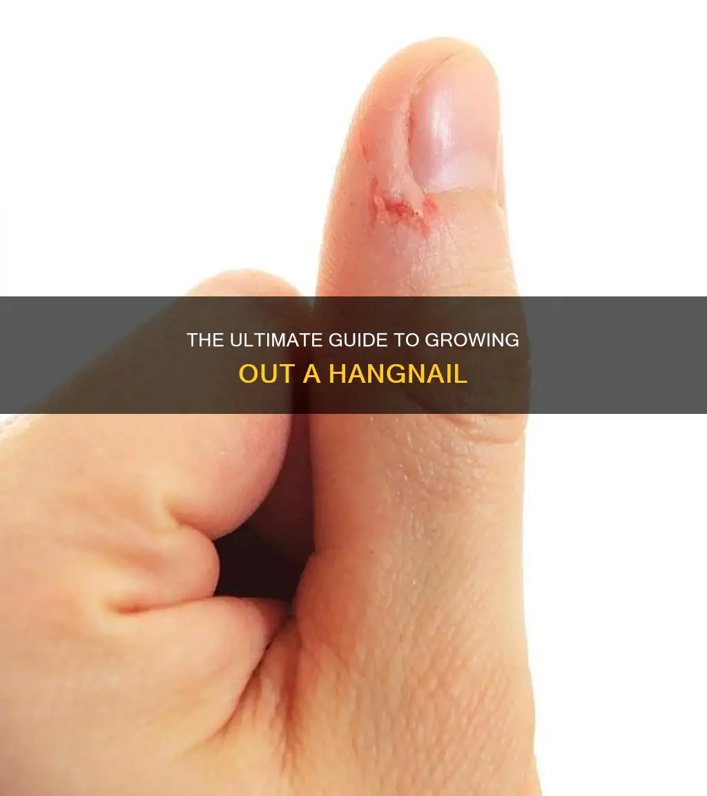 how to grow out a hang nail