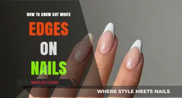White Edges: Tips for Growing Out Healthy Nails