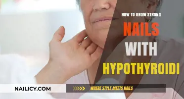 Hypothyroidism and Nail Care: Growing Strong Nails