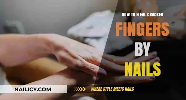 Heal Cracked Fingers: Nail Care Tips for Smooth, Healthy Skin