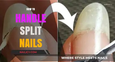 Effective Tips for Repairing and Preventing Split Nails Easily