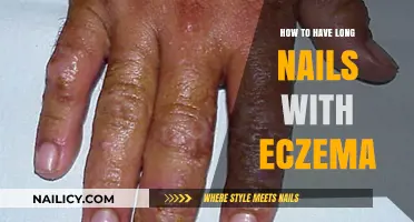 Strong, Long Nails: Eczema-Friendly Strategies