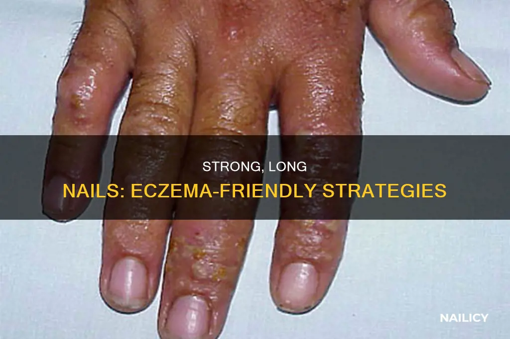 how to have long nails with eczema