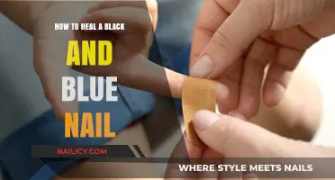 Healing Black and Blue Nails: Effective Remedies and Care Tips