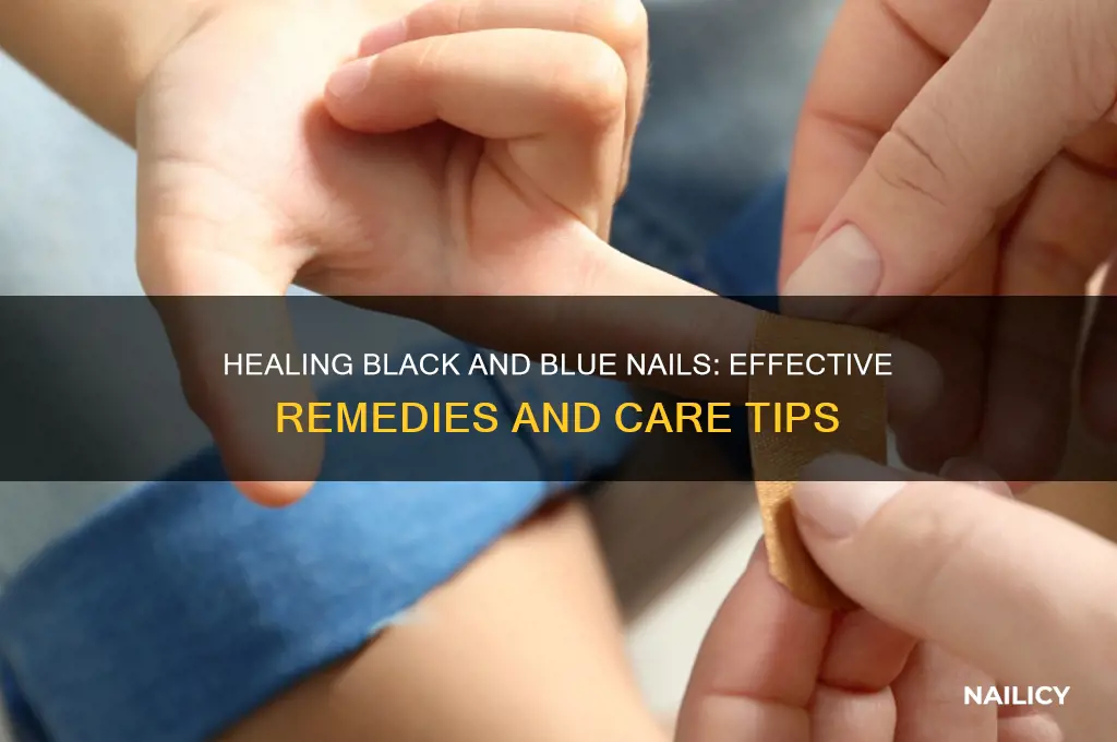how to heal a black and blue nail