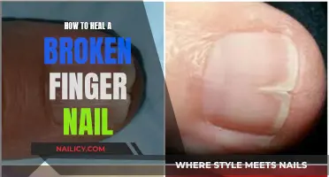 Healing a Broken Fingernail: Quick and Easy Home Remedies