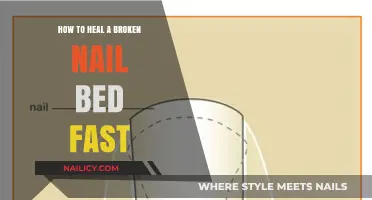 Quick Nail Bed Healing: Effective Tips for Faster Recovery