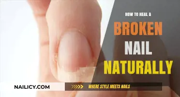 Natural Remedies to Repair and Strengthen Broken Nails Fast