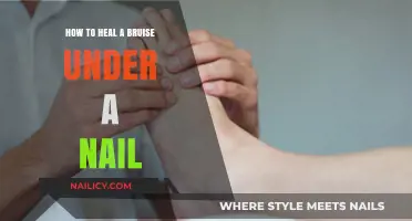 Quick Tips to Heal and Relieve Bruises Under Your Nails
