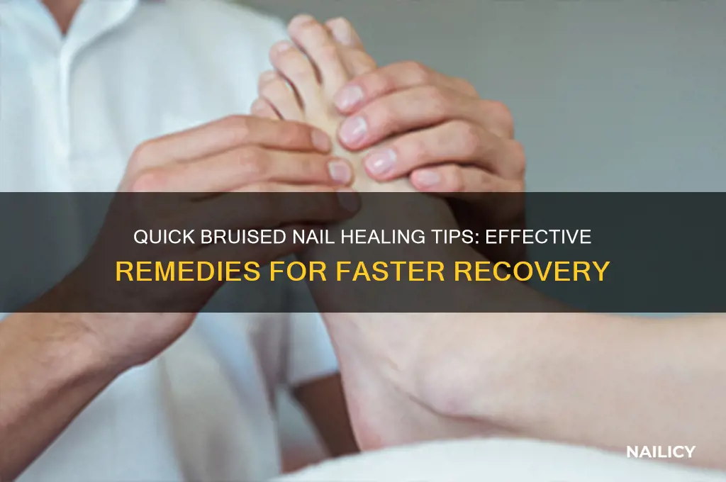 how to heal a bruised nail fast