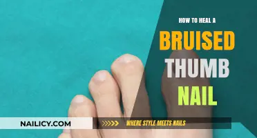 Healing a Bruised Thumb Nail: Quick Tips for Pain Relief and Recovery