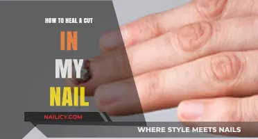 Healing a Cut Nail: Quick and Easy Home Remedies
