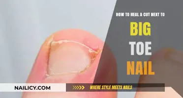 Healing Cuts Near Big Toe Nails: Quick and Easy Guide