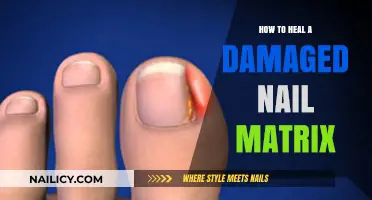 Heal Your Damaged Nail Matrix: Effective Tips for Healthy Nail Growth