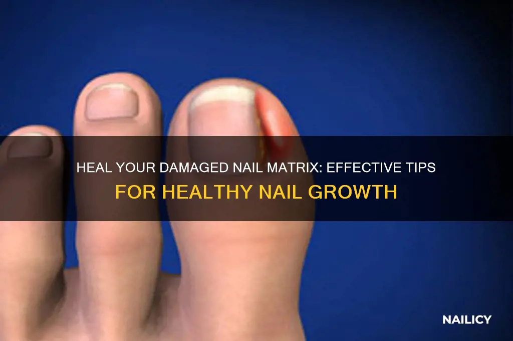 how to heal a damaged nail matrix