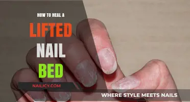 Healing a Lifted Nail Bed: Effective Steps for Quick Recovery