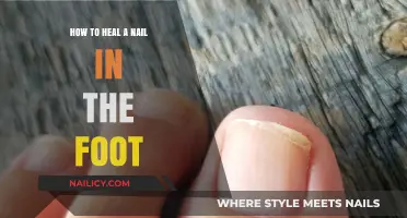 Effective Steps to Heal a Painful Foot Nail Injury Fast