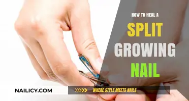 Repair Split Nails: Easy Home Remedies and Tips