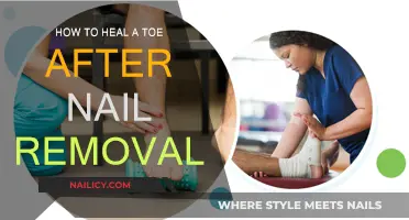 Healing Your Toe: Post-Nail Removal Care