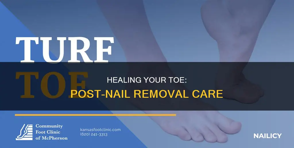how to heal a toe after nail removal