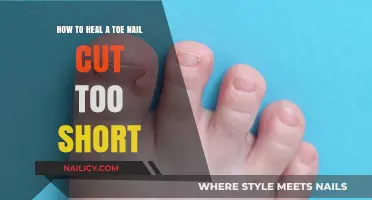 Healing a Toe Nail Cut: Quick Home Remedies