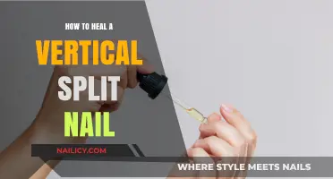 Healing Vertical Split Nails: Effective Tips for Strong, Healthy Nails