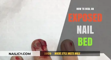 Healing an Exposed Nail Bed: Effective Remedies and Care Tips