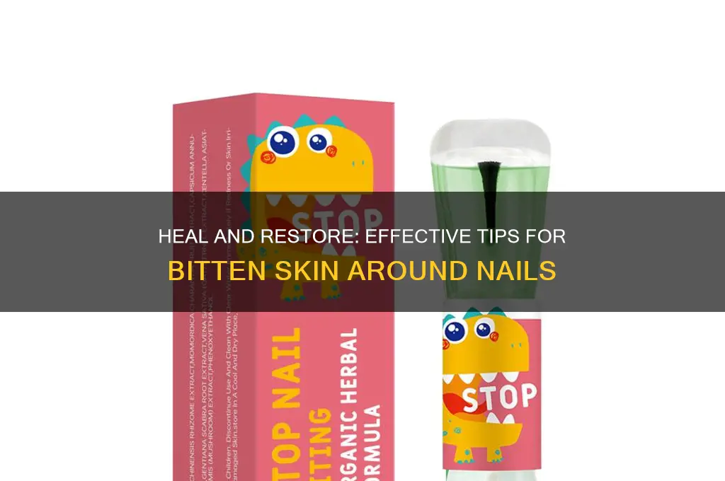 how to heal bitten skin around nails