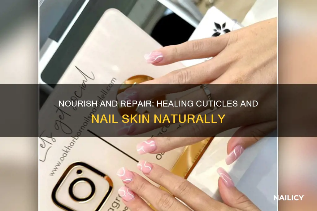 how to heal cuticles snd skin around nails