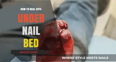 Healing Cuts Under Nail Beds: Quick and Easy Home Remedies