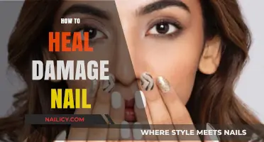 Restore & Repair: Effective Tips to Heal Damaged Nails Naturally
