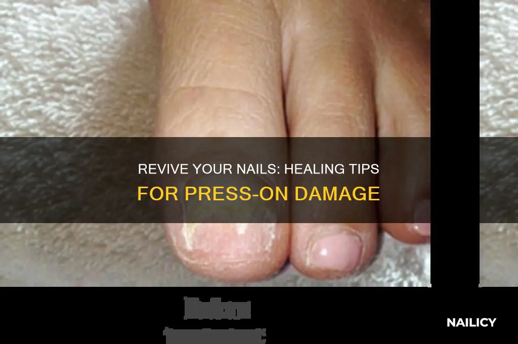 how to heal damaged nails from press ons