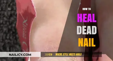 Revive Your Dead Nail: Effective Healing Tips and Remedies