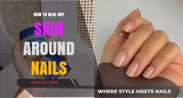 Nourish and Repair: Effective Tips to Heal Dry Skin Around Nails