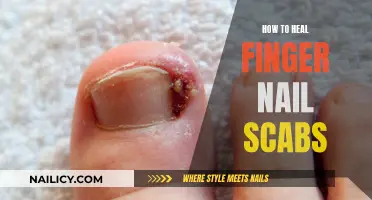 Healing Finger Nail Scabs: Quick and Easy Home Remedies